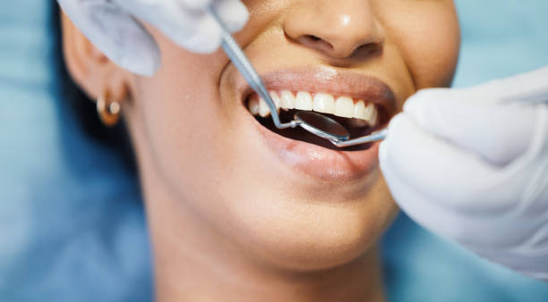 Best Emergency Treatment for Dental Infections or Abscesses in Imlay City, MI